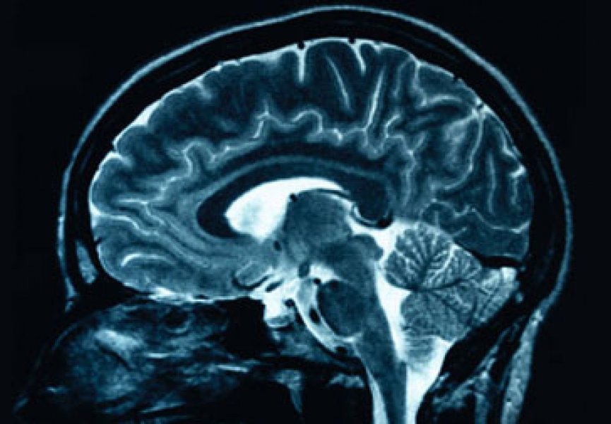 9567-brain_hororr.crop865x600.jpg 9567-brain_hororr.crop865x600.jpg